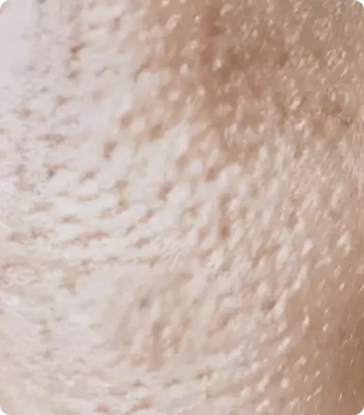 Visible pores