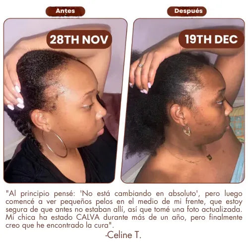 Biotin Hair Growth Oil