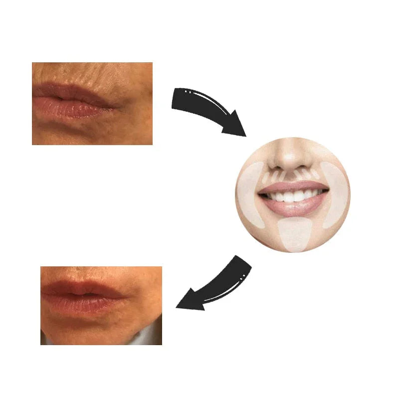 New Botox Anti-Wrinkle Patches - 18 Pieces