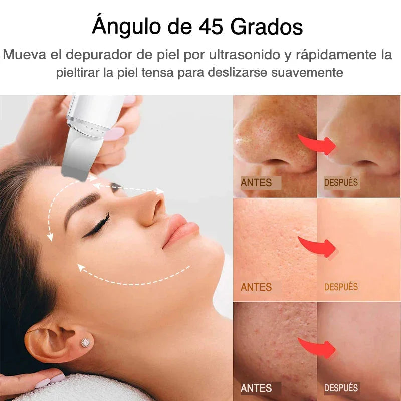 DermaVibra Ultrasonic Skin Scrubber for Radiant Skin