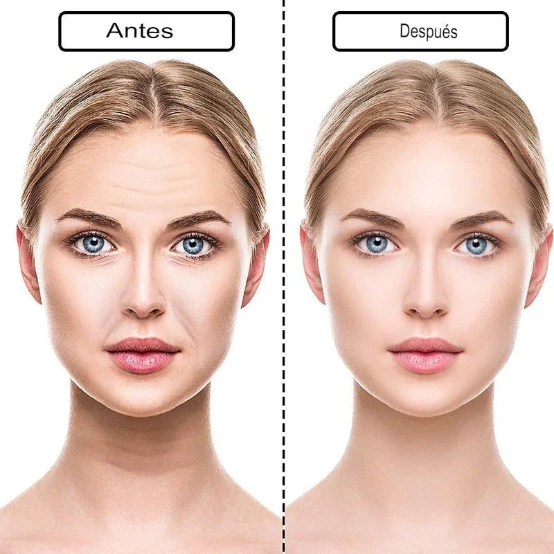 New Botox Anti-Wrinkle Patches - 18 Pieces