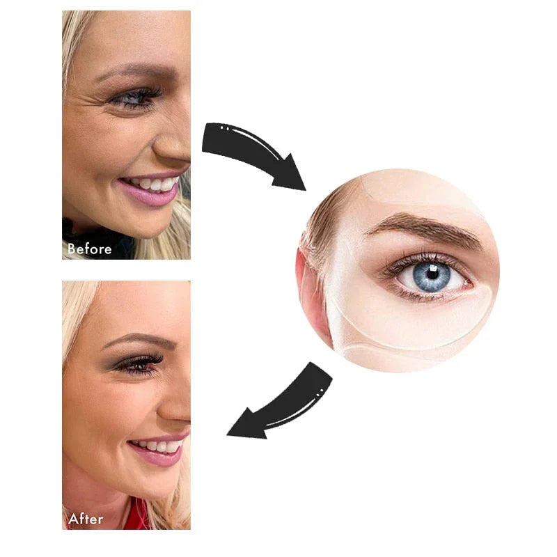 New Botox Anti-Wrinkle Patches - 18 Pieces