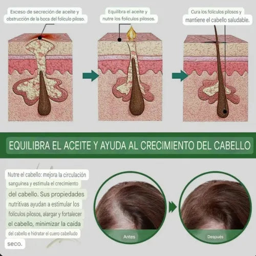 Rosemary Oil | Say Goodbye to Hair Loss!