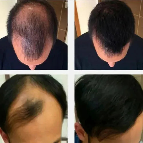 Rosemary Oil | Say Goodbye to Hair Loss!