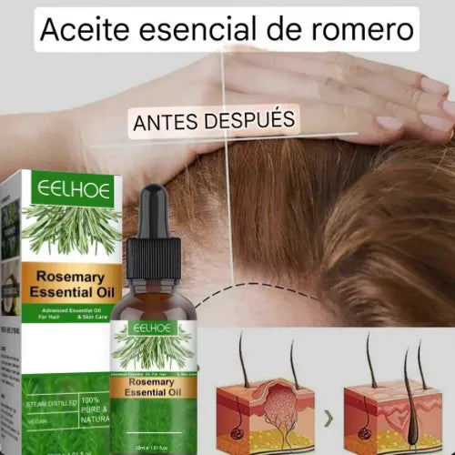 Rosemary Oil | Say Goodbye to Hair Loss!