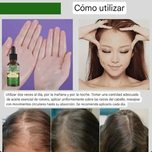 Rosemary Oil | Say Goodbye to Hair Loss!