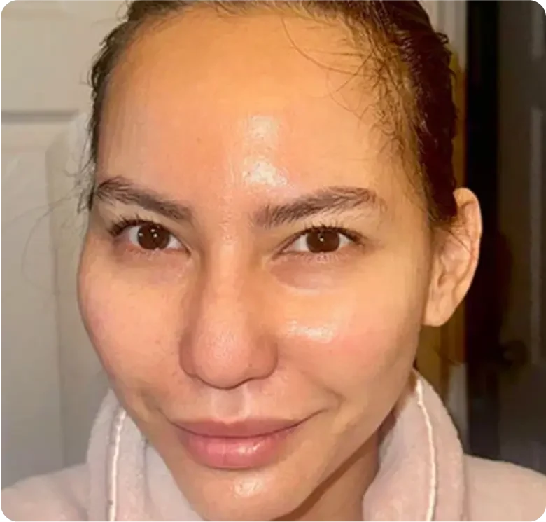 Mask experience shared by Angela M.