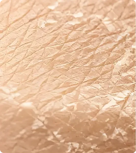 Dry, rough texture