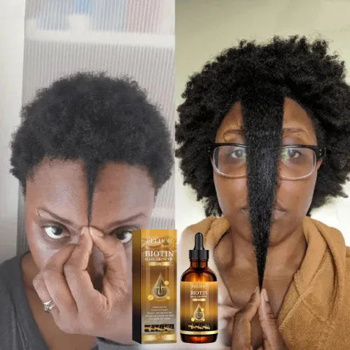 Biotin Hair Growth Oil