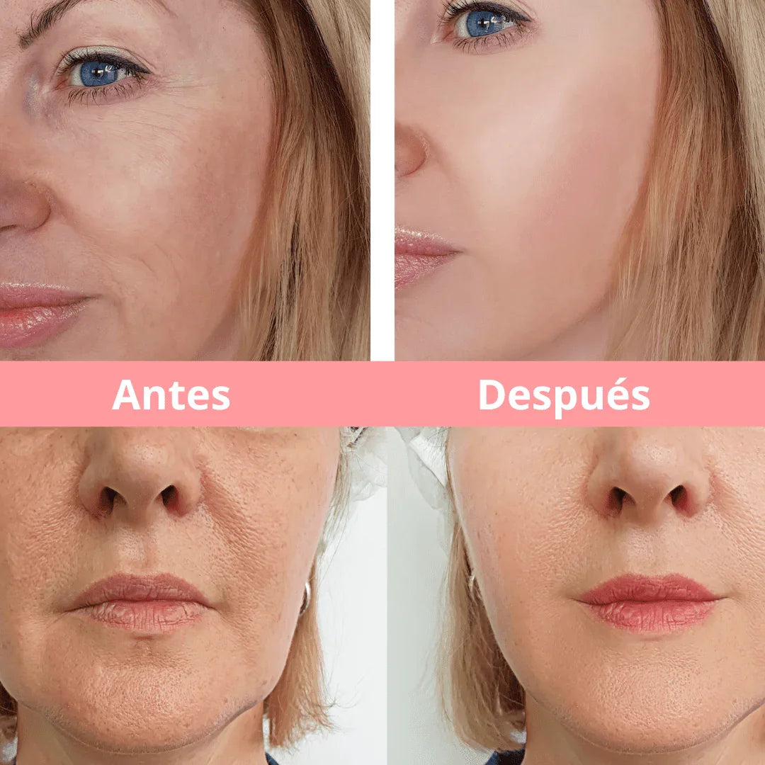 DivineSkin Double Chin Reducer &amp; Anti-Aging Device